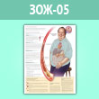 Плакат «Что такое метаболический синдром?» (ЗОЖ-05, ламинир. бумага, A1, 1 лист)